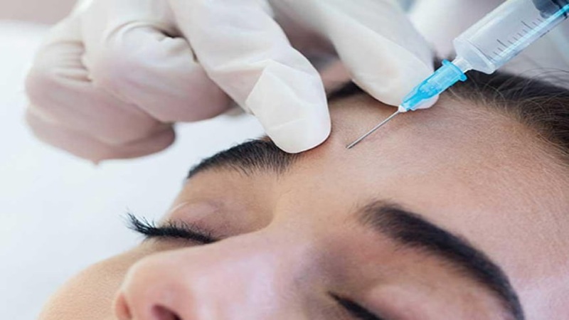 بوتاکس چند ماه ماندگاری دارد؟