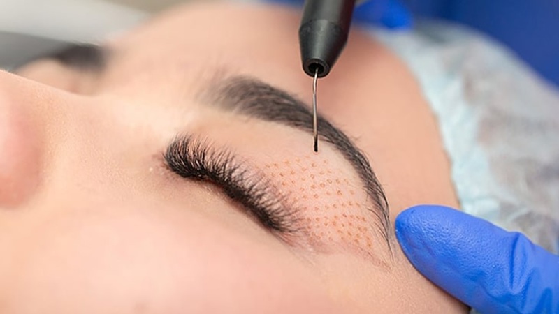 پلاسماجت چه کاربردی دارد؟