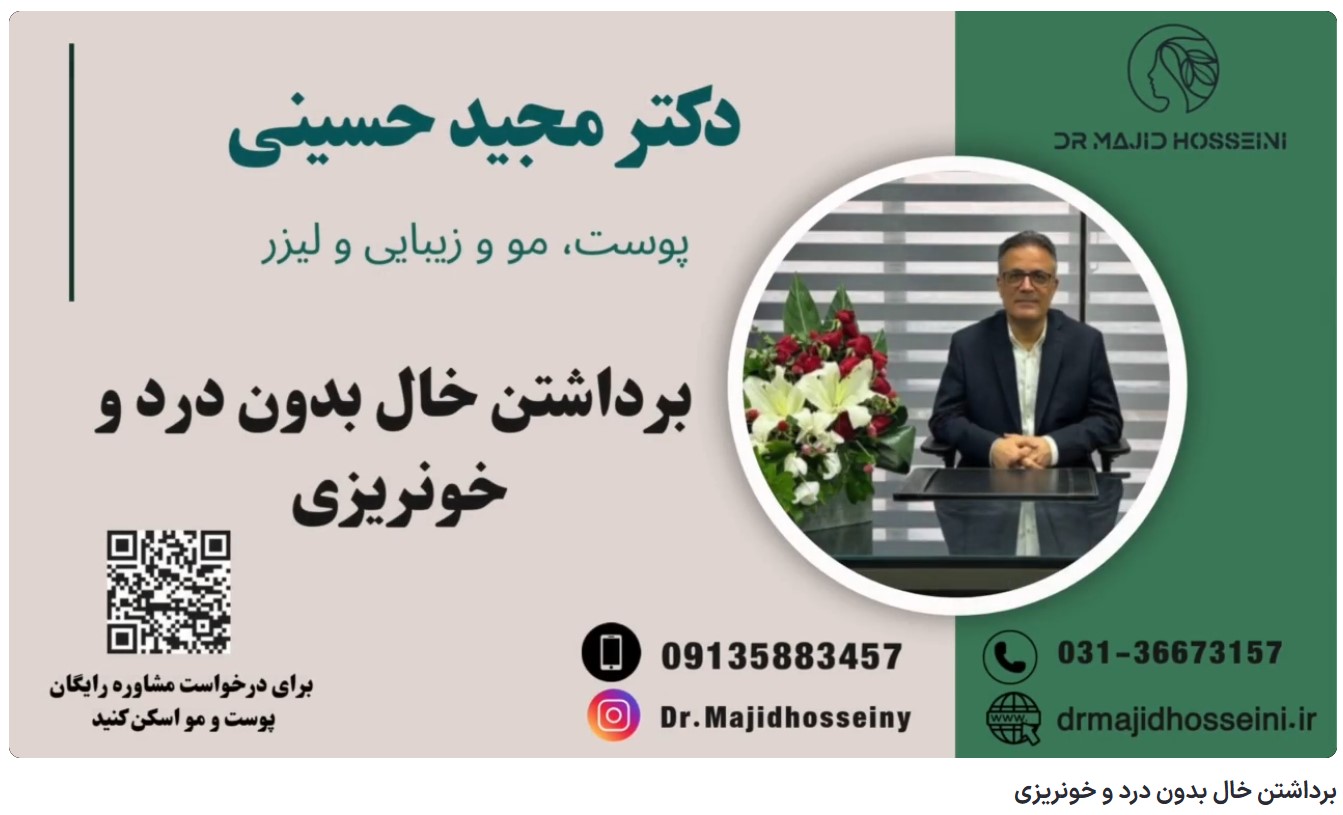 ویدئو یوتیوب برداشتن خال بدون درد و خونریزی