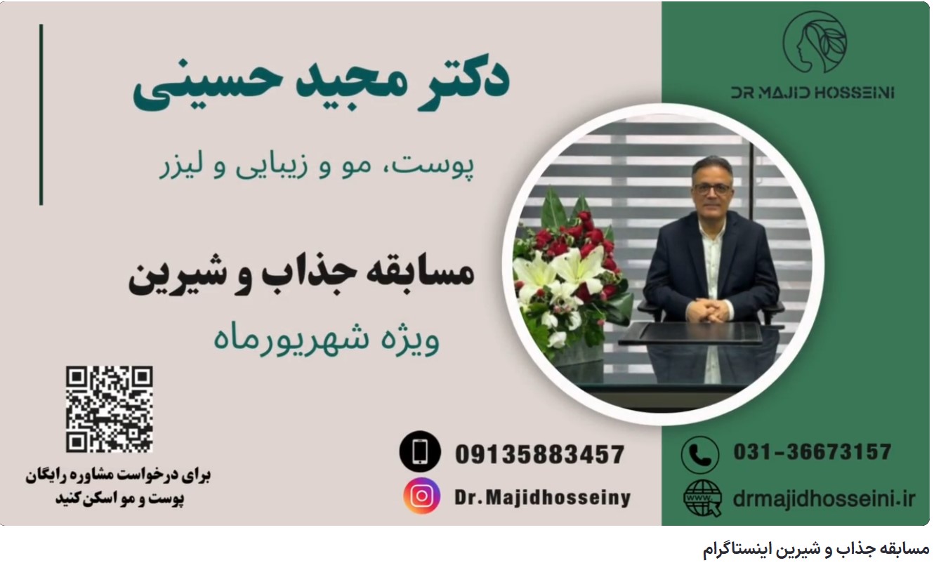 ویدئو آپارات مسابقه جذاب و شیرین اینستاگرام