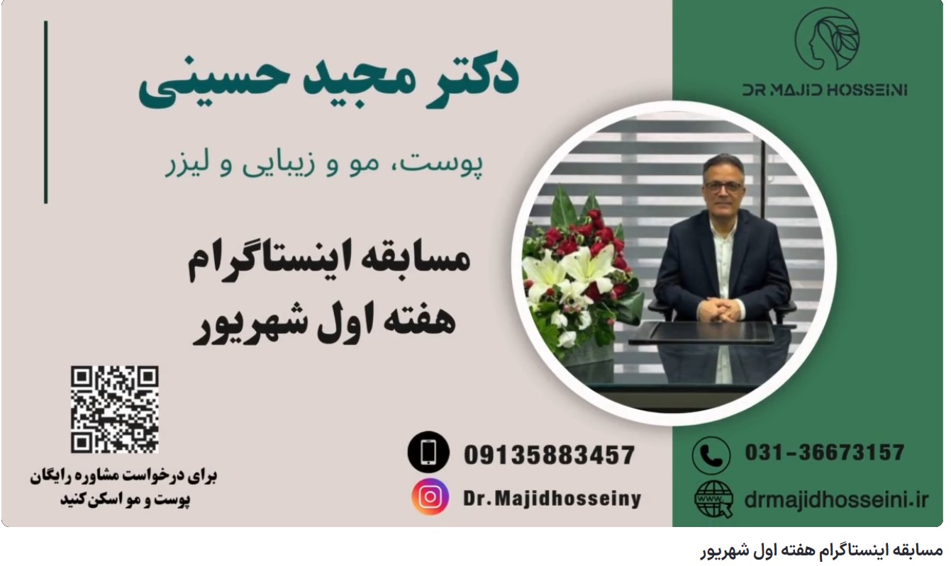 ویدئو آپارات مسابقه اینستاگرام هفته اول شهریور