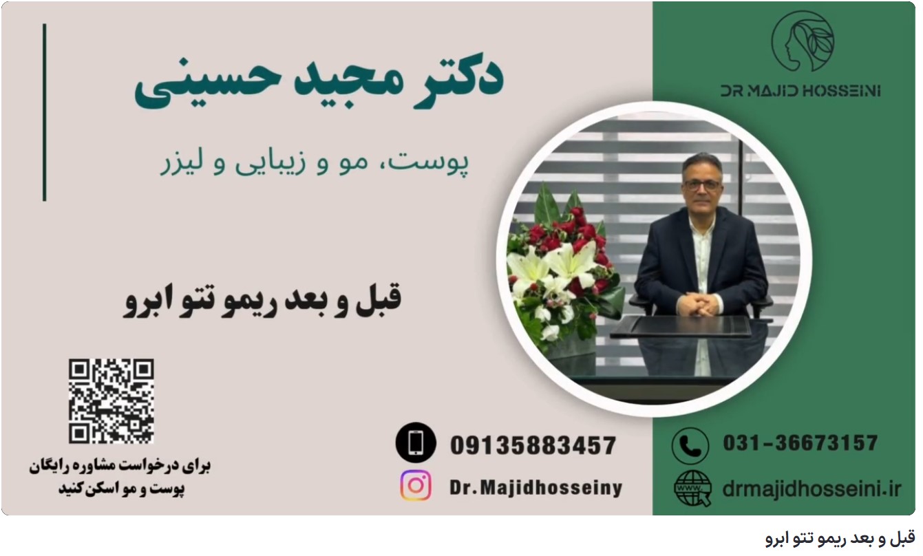 ویدئو آپارات قبل و بعد ریمو تتو ابرو