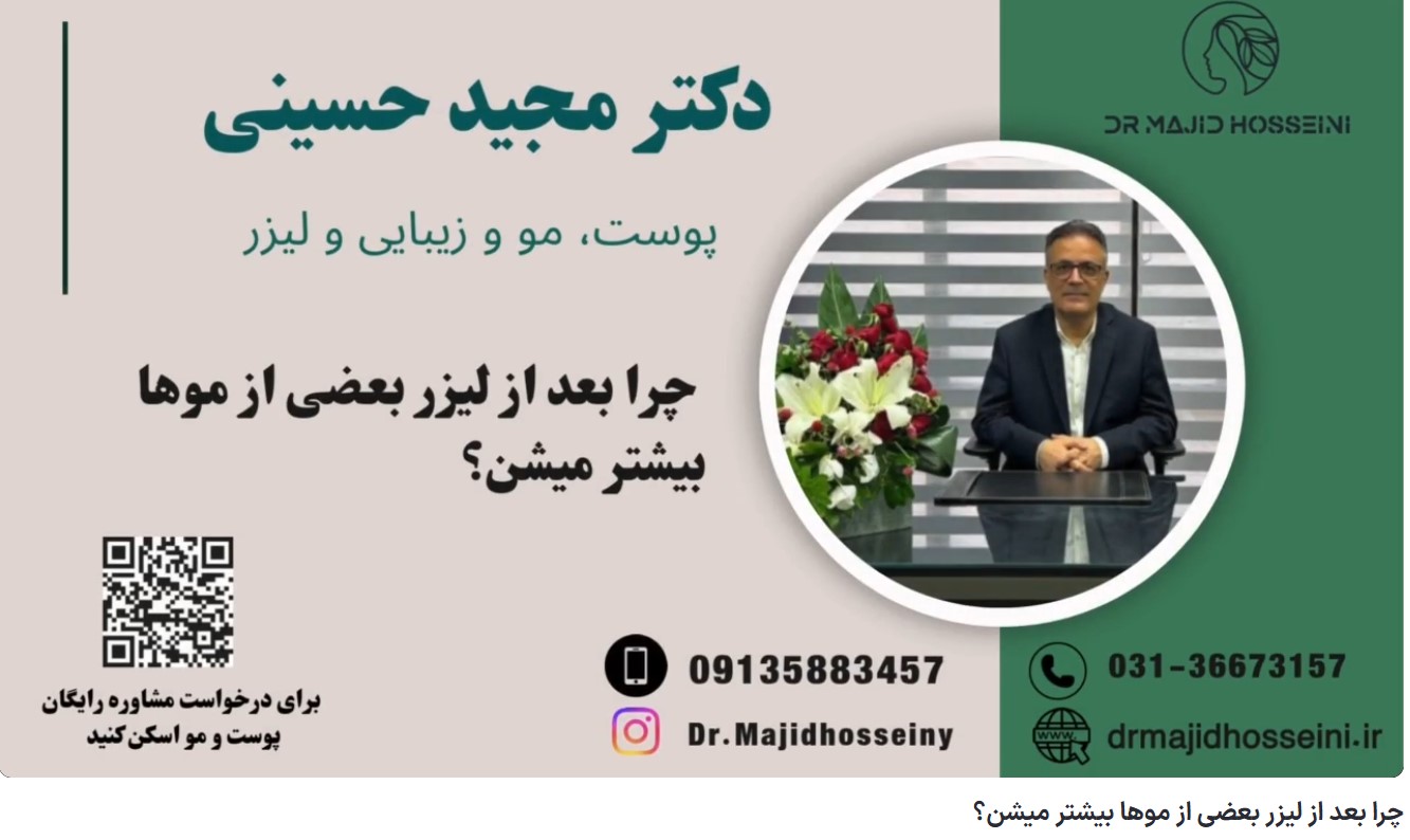 ویدئو آپارات چرا بعد از لیزر بعضی از موها بیشتر میشن؟