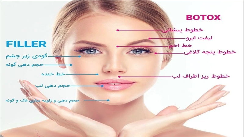 مقایسه بوتاکس با فیلرها