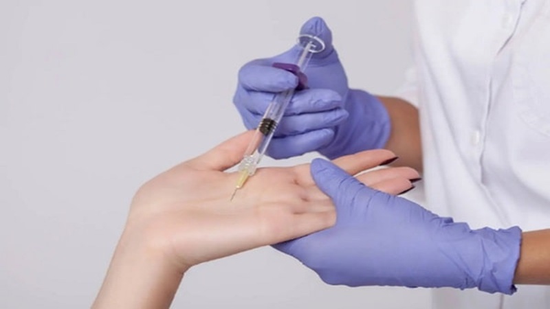 بوتاکس برای درمان تعریق زیاد (هایپرهیدروز)