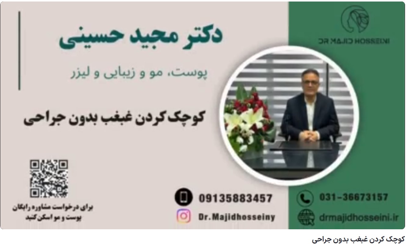 ویدئو آپارات کوچک کردن غبغب بدون جراحی