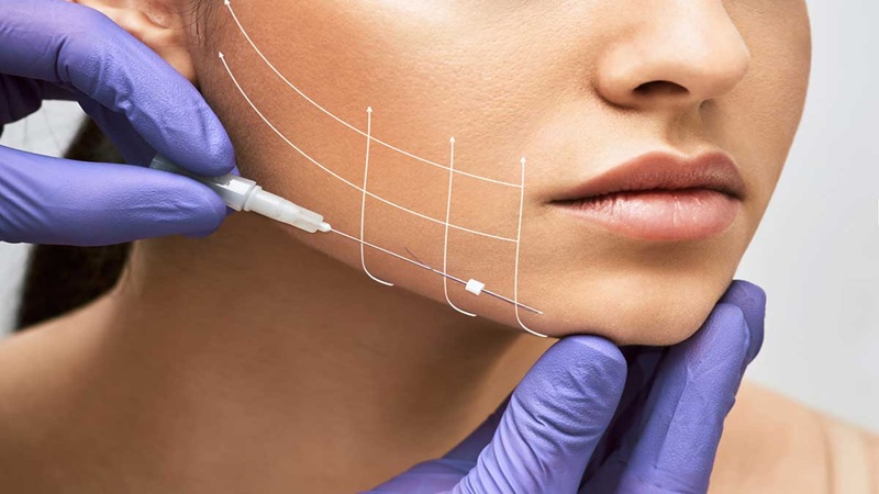 نحوه انتخاب پزشک مناسب برای لیفت با نخ