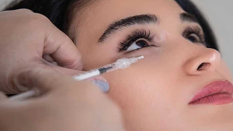 مزوژل برای درمان تیرگی زیر چشم