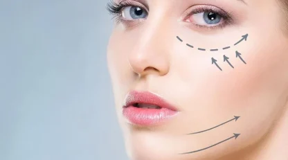 تأثیر مزوژل بر روی نواحی مختلف صورت