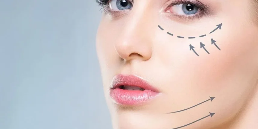 تأثیر مزوژل بر روی نواحی مختلف صورت