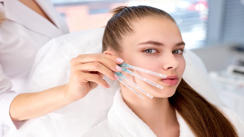 روش‌ها و تفاوت‌های لیفت با نخ