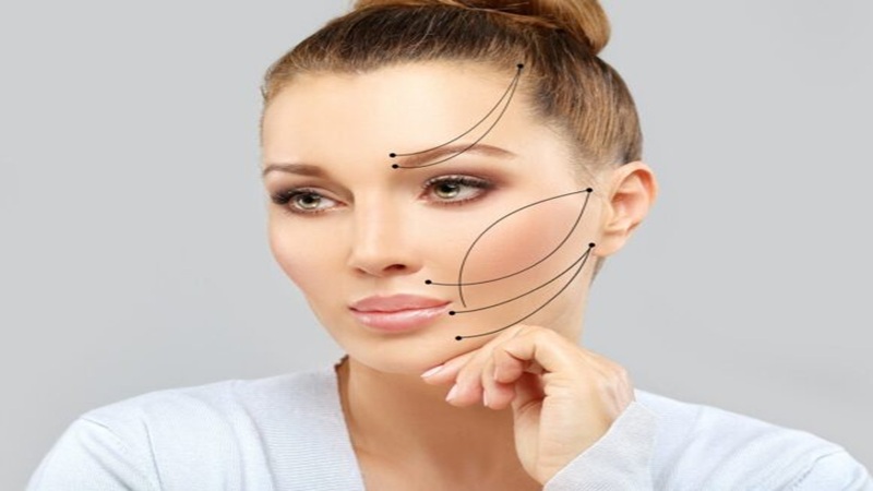 نقش لیفت با نخ در درمان افتادگی پوست گردن