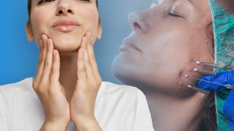 تجربیات بیماران بعد از لیفت با نخ