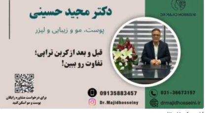 ویدئو یوتیوب قبل و بعد کربن تراپی:تفاوت رو ببین