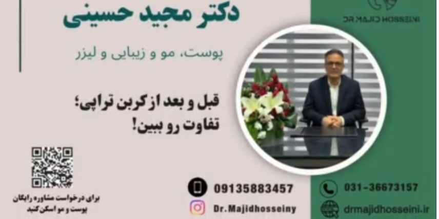 ویدئو یوتیوب قبل و بعد کربن تراپی:تفاوت رو ببین