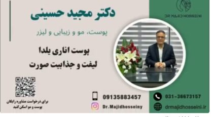 ویدئو آپارات پوست اناری یلدا؛ لیفت و جذابیت صورت