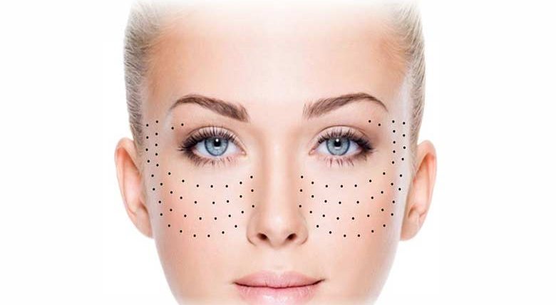 مراقبت‌های لازم بعد از تزریق مزوژل